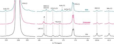 Detecting de novo Hepatic Ketogenesis Using Hyperpolarized [2-13C] Pyruvate